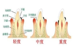 “心口”相依|牙周炎竟與全身這么多疾病有關(guān)......